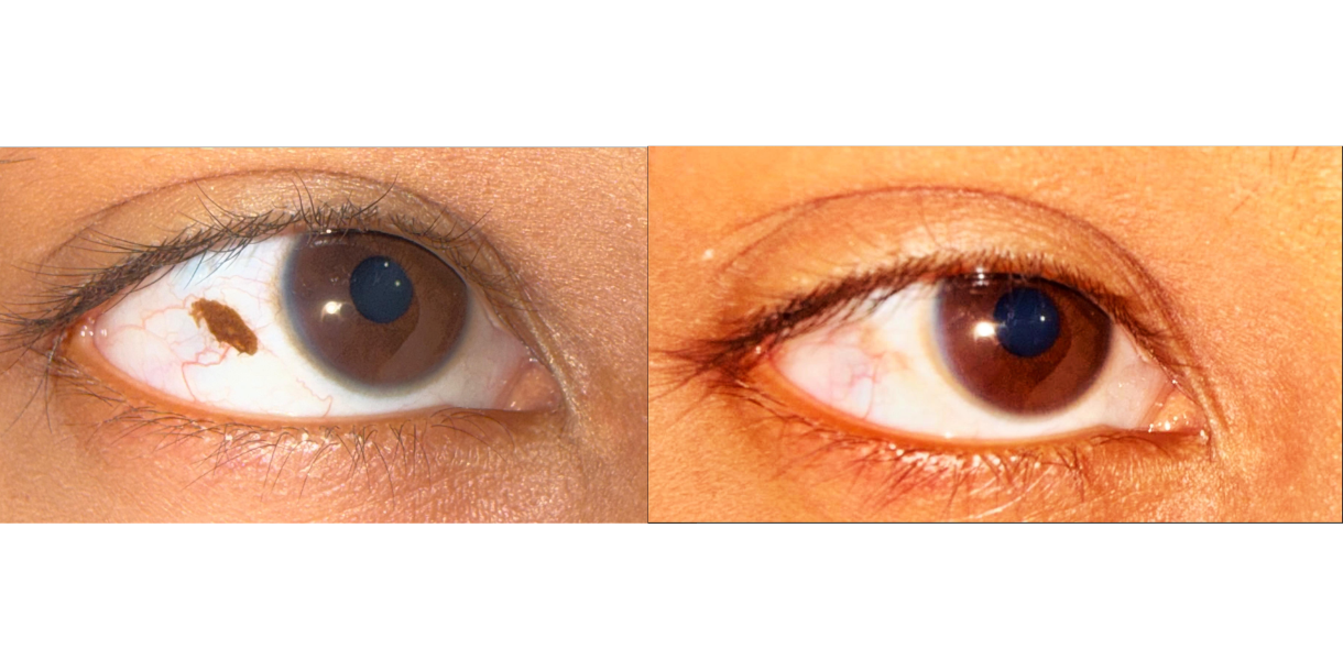 oculoplastic-and-aesthetic-services