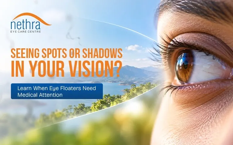 why-do-i-see-floaters-in-my-eyes