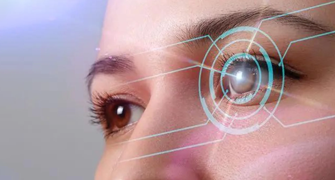 Lasik Surgery